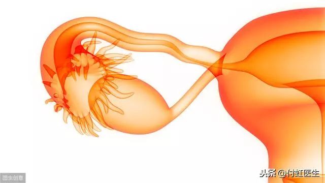 肚子疼医生诊断"附件炎",附件到底是什么地方?
