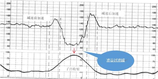 孕晚期发现胎心监护不好怎么应对？