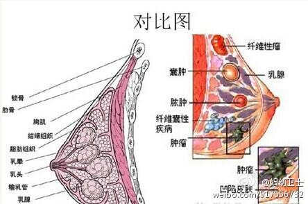 站在鏡子前,雙手垂下,看看乳房外觀是否正常,乳頭有無凹陷,皮膚有無