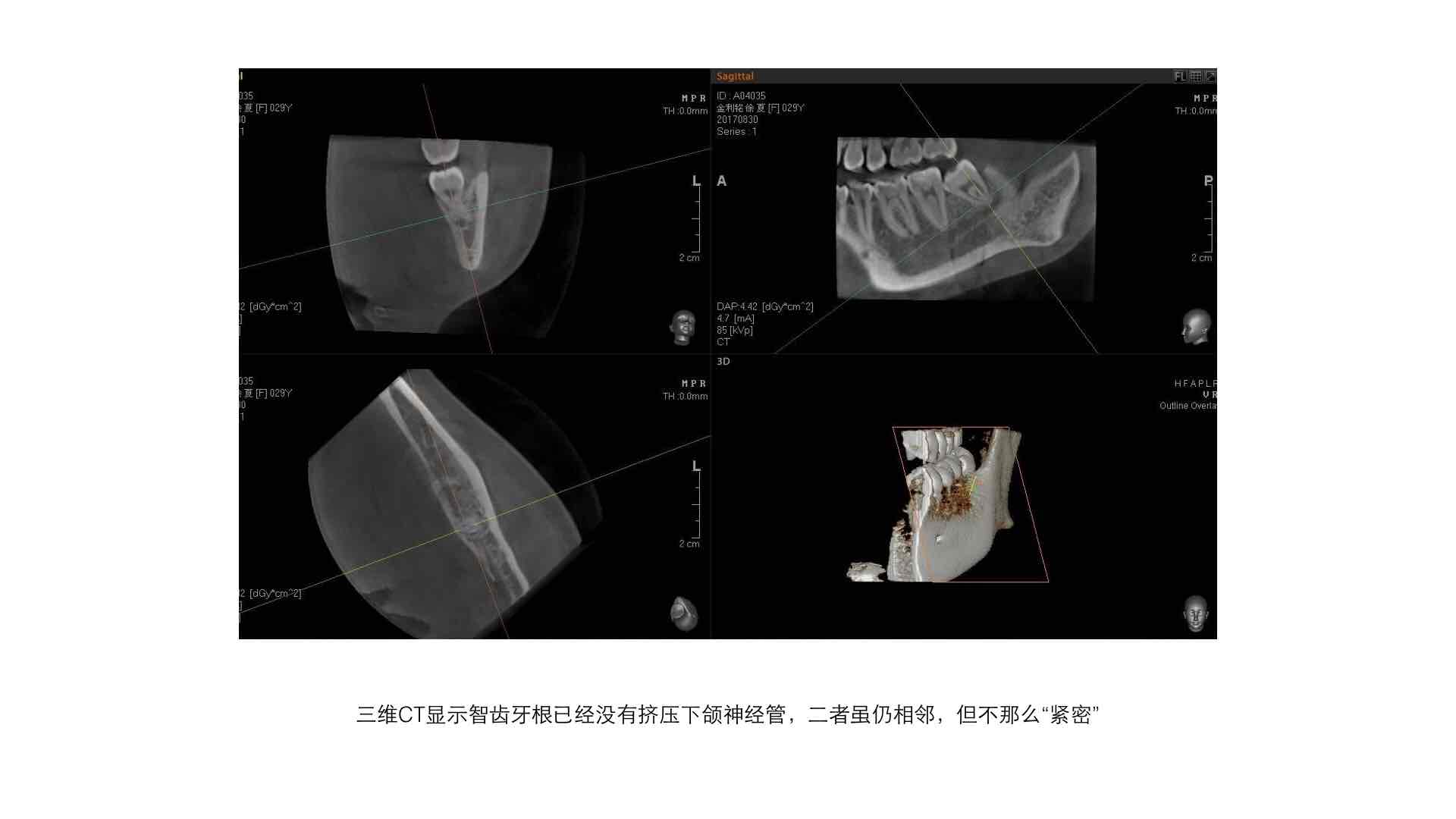 拔智齒我們除了專業態度也非常認真