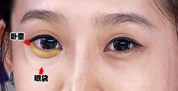 卧蚕和眼袋的位置