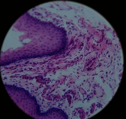 下面两张图,就是皮肤毛囊的切片:毛囊的主要功能就是合成人体的毛发.