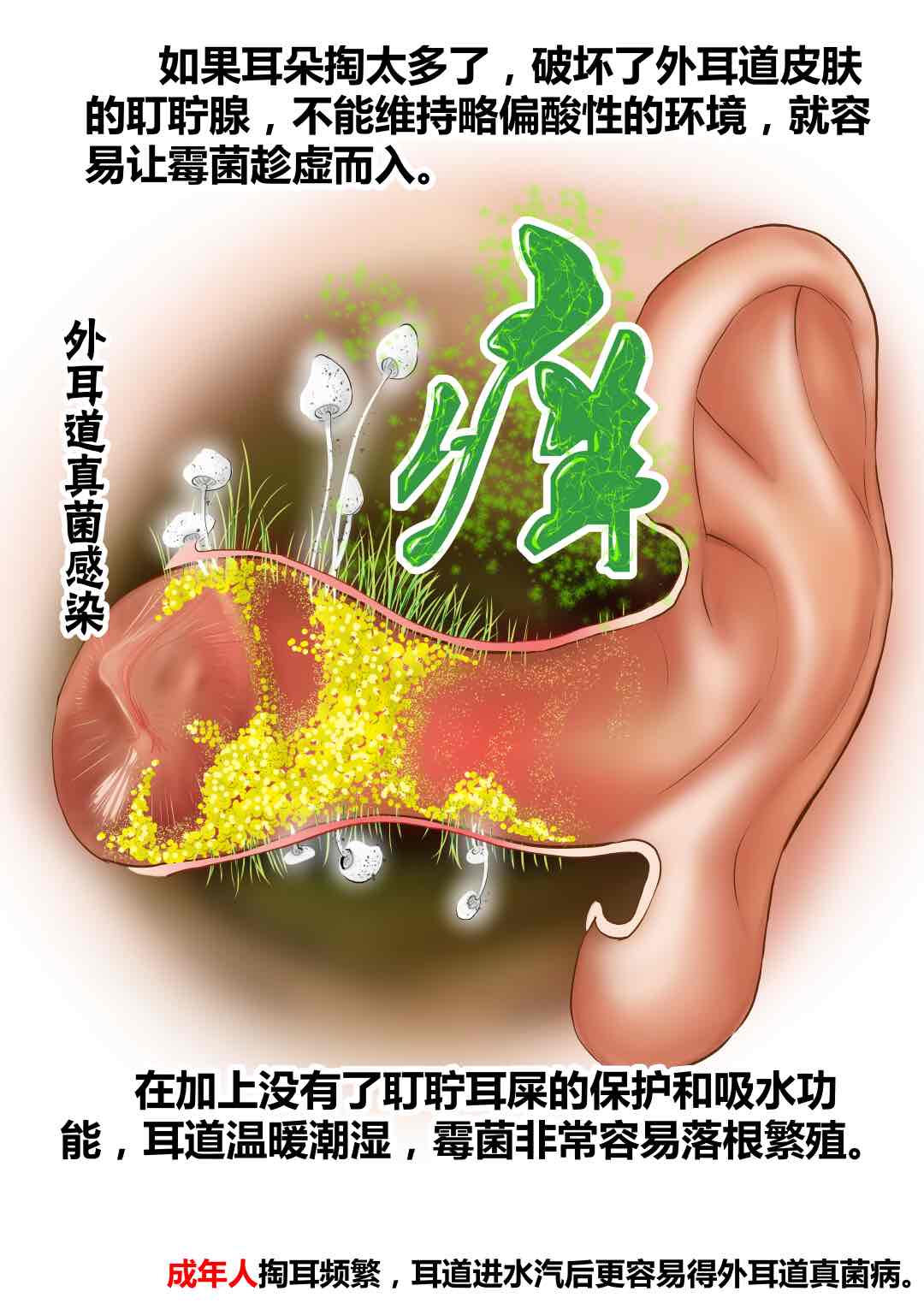 掏耳朵越掏越痒怎么办?