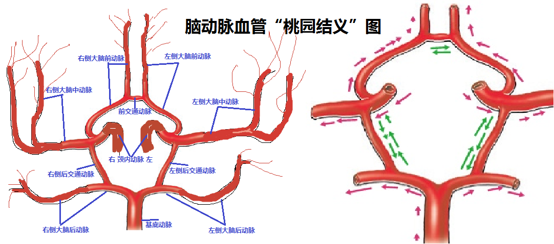 供应大脑的主要血管图图片