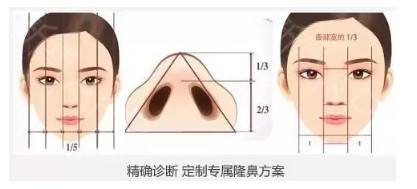 智商税 鼻夹真的可以增高鼻梁缩小鼻头吗 吴国平主任医师 爱问医生