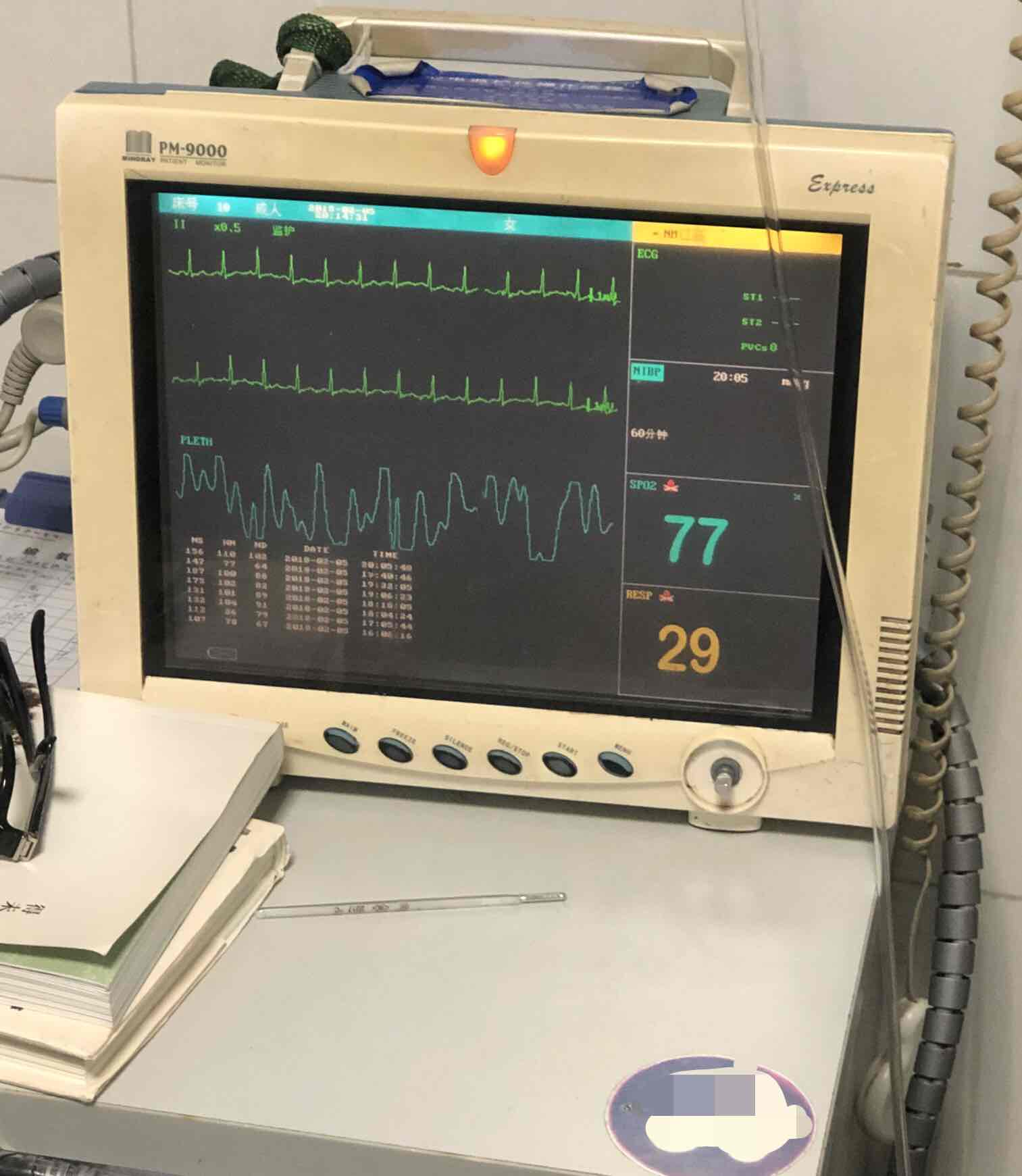 缺氧的简单判断-血氧饱和度检测