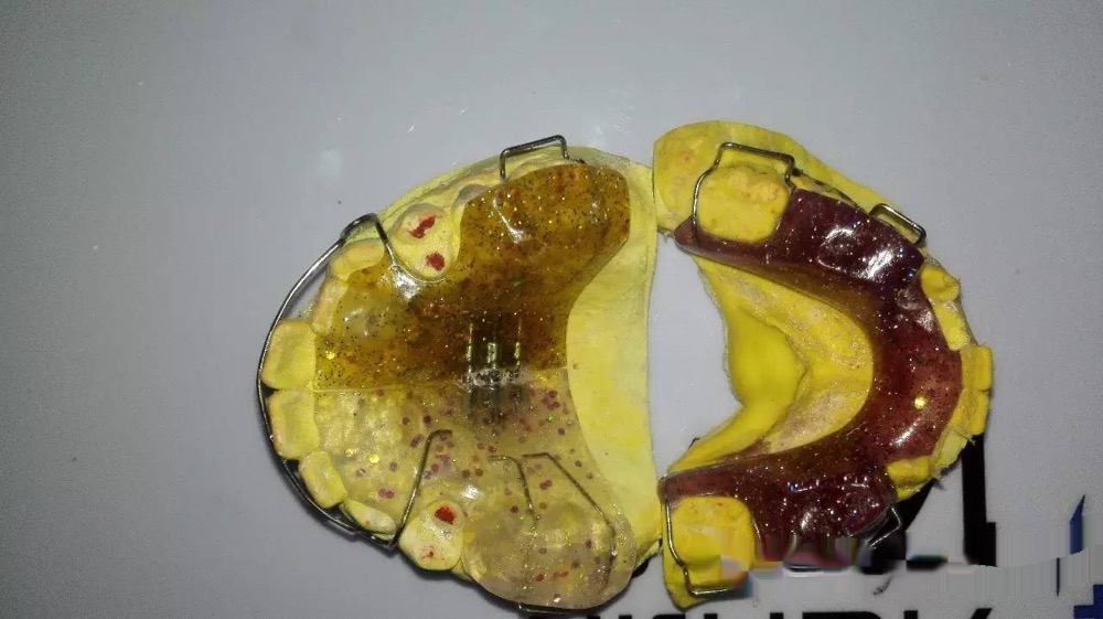 我为何选择放弃twinblock矫治器