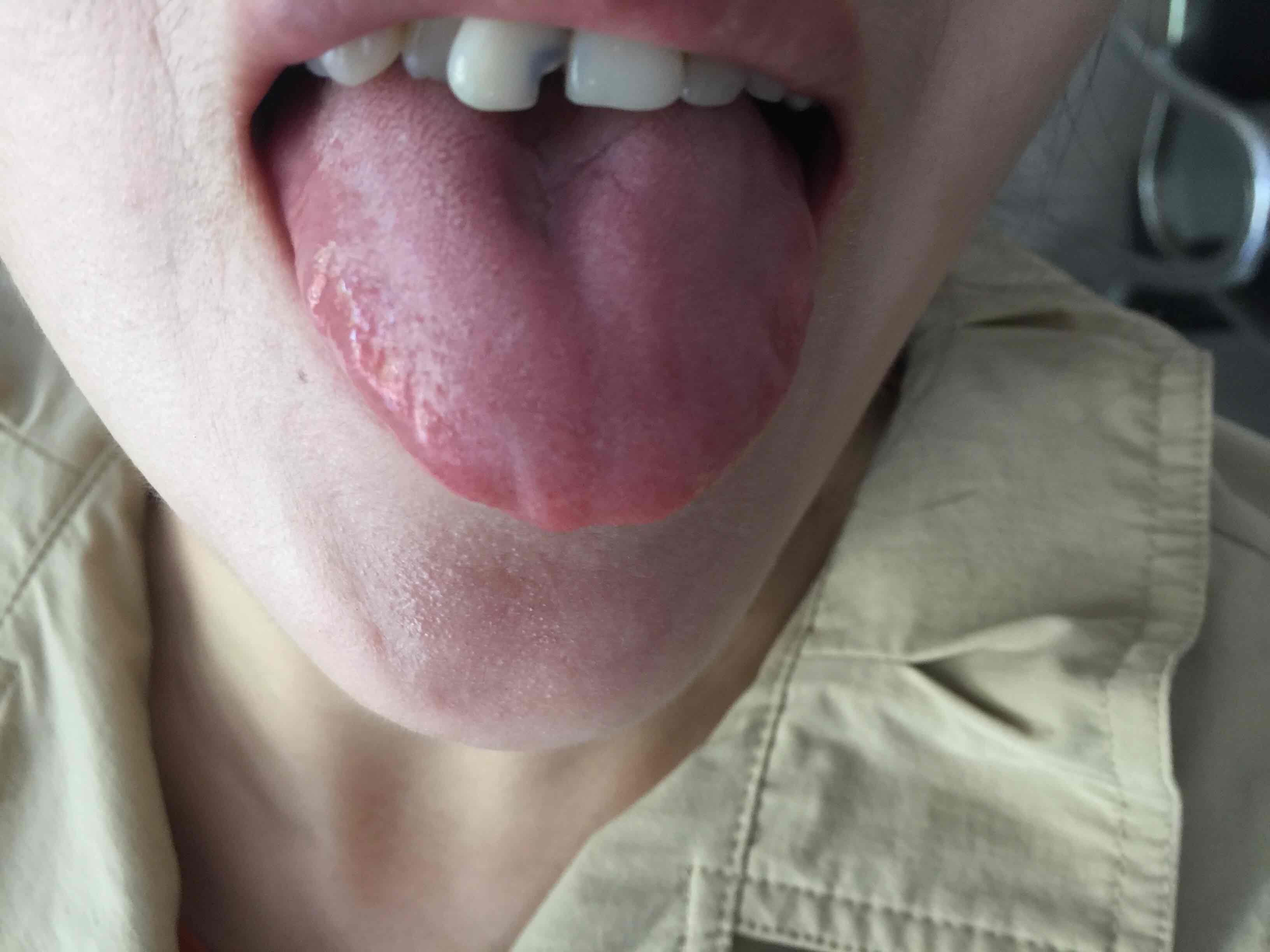 麻黄3附子7细辛3红参10麦冬10五味子10当归10赤芍10白蒺藜10密蒙花20