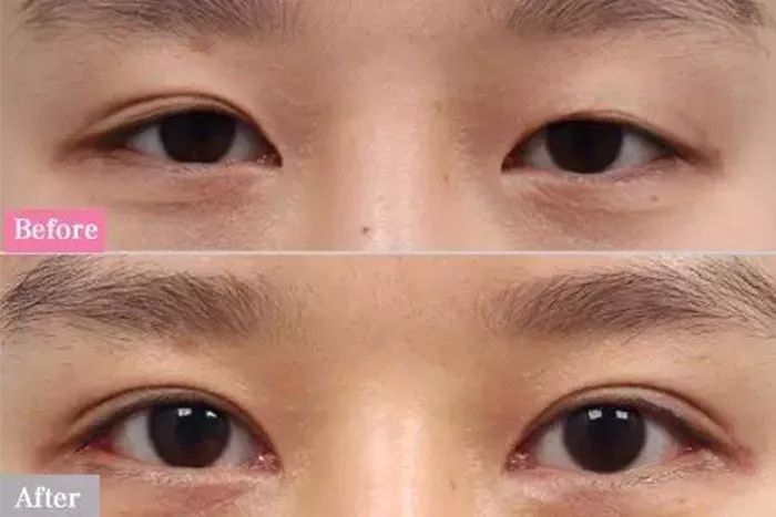 一双眼睛可以毁掉一张脸,也能拯救一张脸-聂丽丽主治医师-爱问医生