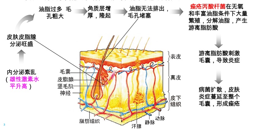 看皮肤科医生如何教你只留青春不留痘