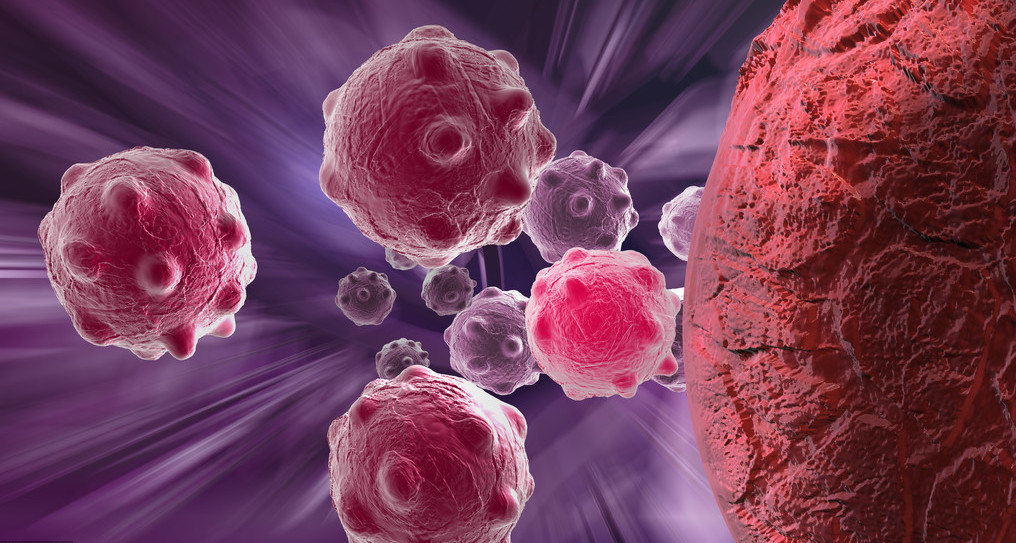 癌细胞突变的诱因终于水落石出,这类细胞会酿造成癌?