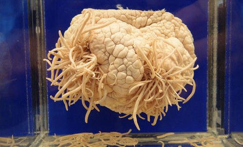 过敏性紫癜医院_换季谨防过敏性紫癜!史淑荣工作室整理