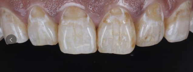 你知道可乐牙长啥样的吗?