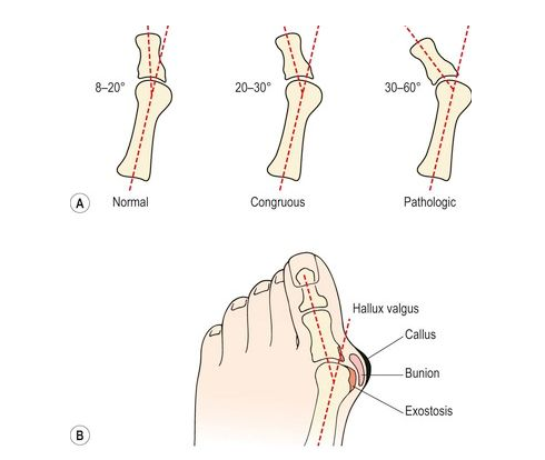 脚大拇指的结构全图图片