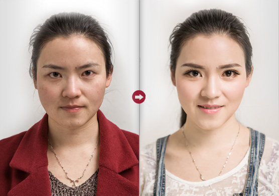 【梁虹护肤】她都已经把斑祛掉了~你还不赶紧来?