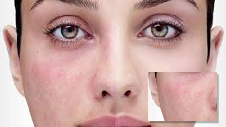 皮肤过敏≠敏感肌,如何判断自己的皮肤状态属于哪一种?