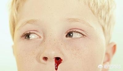 小孩鼻腔内壁充血发红图片