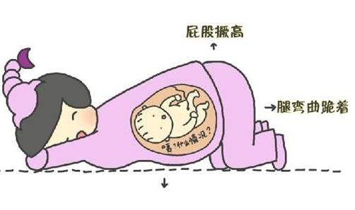 胎位不正将不能顺产,有什么办法逆天改命么?