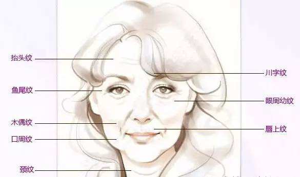 我们首先要知道自己的皱纹是属于什么性质,给大家分析一下面部皱纹的