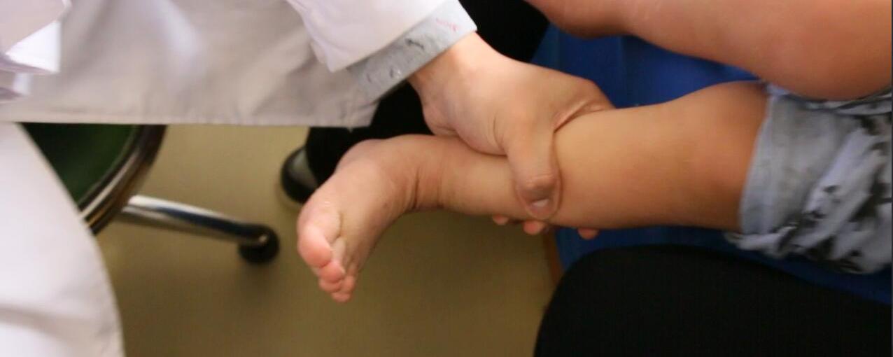 放大招马蹄内翻足按摩教程拿走不谢