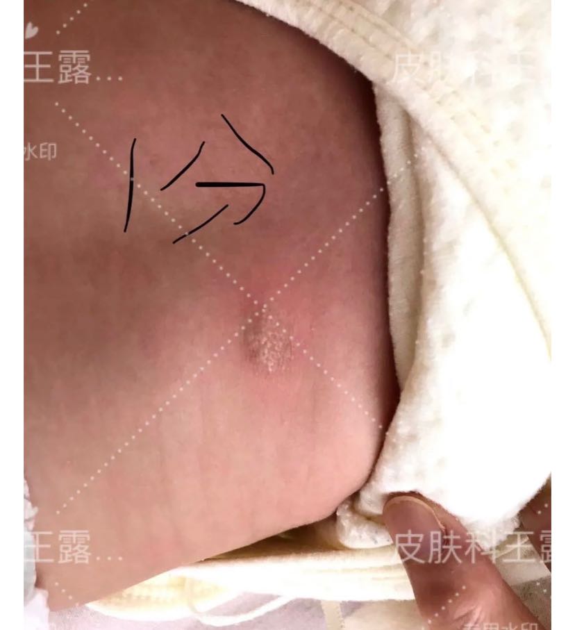 网络咨询的一例肥大细胞瘤