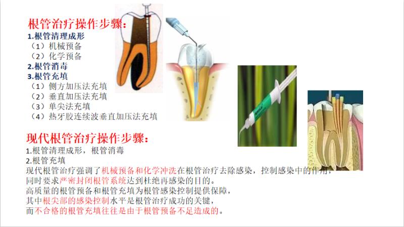 《什么是根管治疗?》