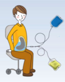 尿毒症患者透析能活多久?医生一般不会多讲!