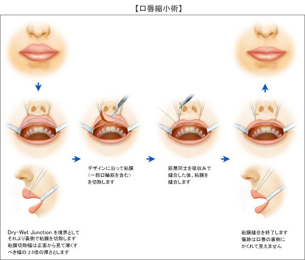 面若桃花,唇若蕊