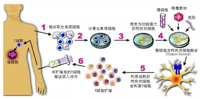 什么是免疫治疗?