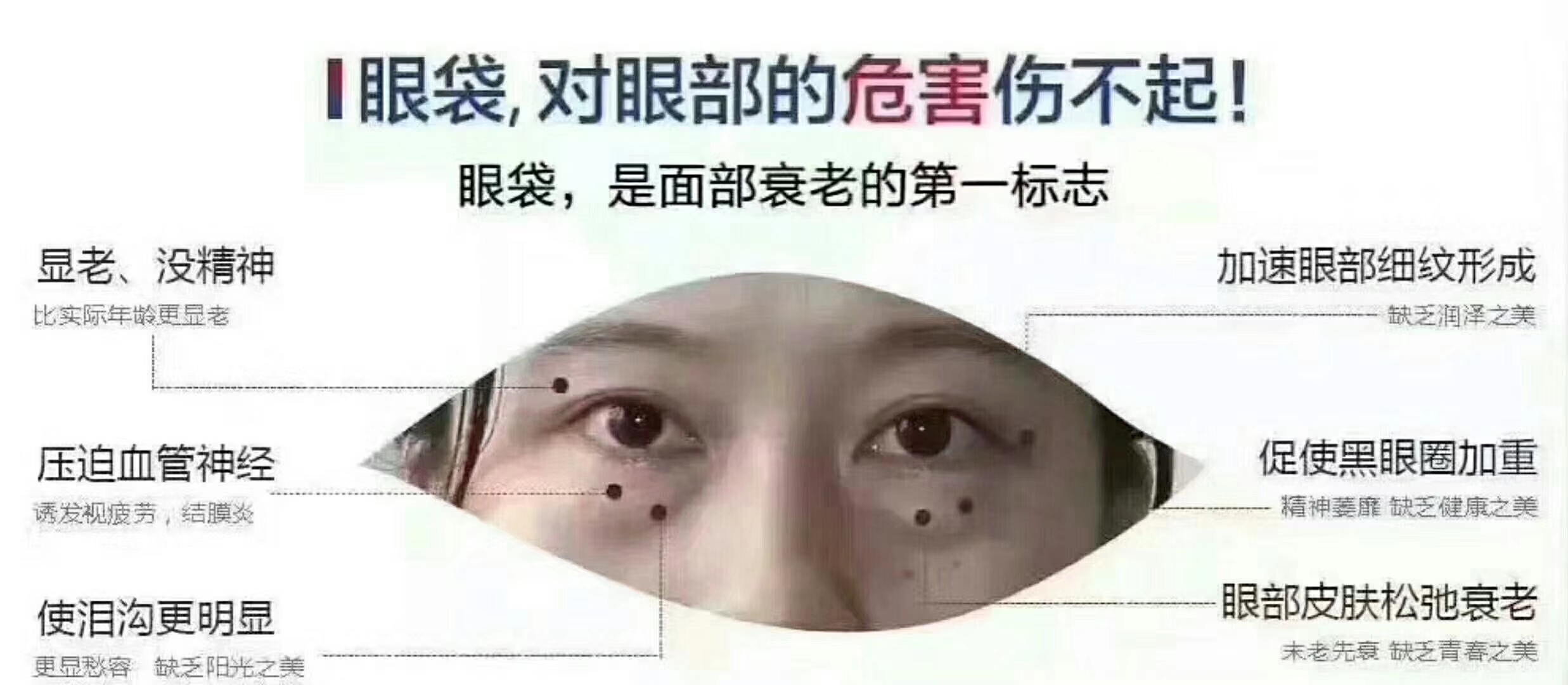 眼袋的危害1.jpg