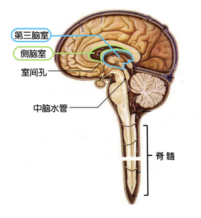 是非常清楚的,因为ct能够看到侧脑室的宽度,也能够看到三脑室和四脑室