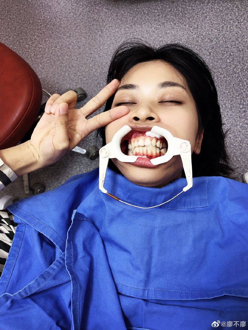 深圳隐适美粘附件|廖同学的牙套日记投稿