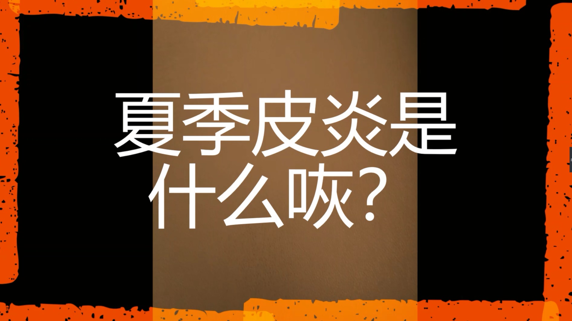 夏季皮炎是夏季高溫天氣環境下,皮膚受刺激引起的炎症性皮膚病,一般