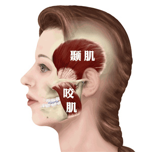 牙齿矫正牙套脸之谜