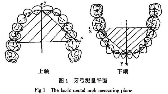 但是遗传,或个人不良的生活习惯牙弓会发生"叛变"牙弓不对称会导致脸