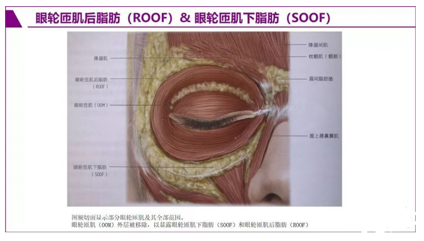 双眼皮解剖结构图解图片