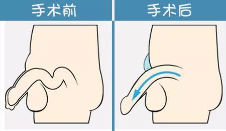 最后,我想要提醒男性朋友们,想要延长丁丁的男性朋友,千万不要太心急