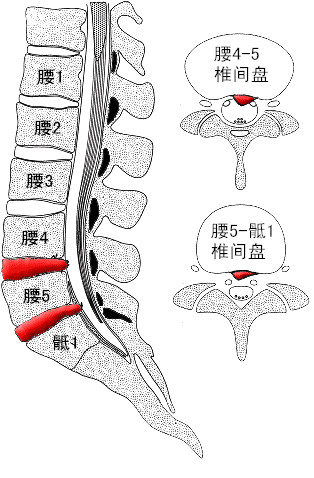 正常腰椎形状图片大全图片