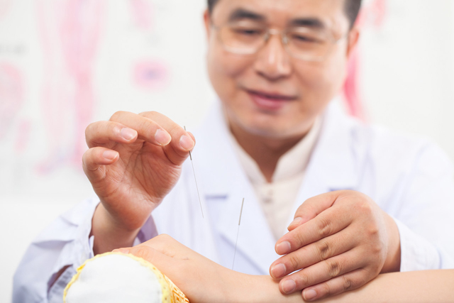 医生针灸 手背针灸.jpg