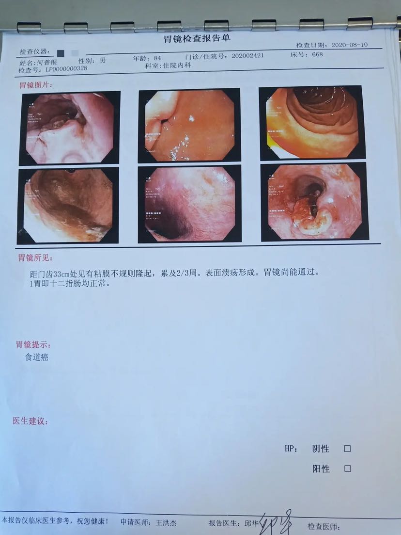 食道癌活检报告图片图片