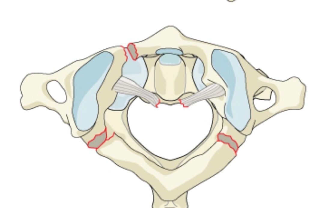 柳叶刀上镌刻幸福无影灯下守护初心神经脊柱医者感悟