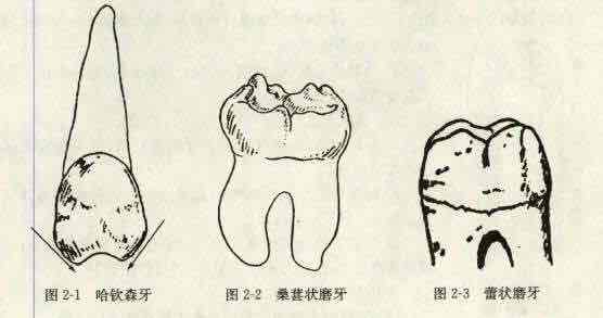 梅毒的全身和口腔疾病反应