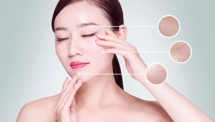 上饶尚美:光子嫩肤的三大传言,你听过吗?