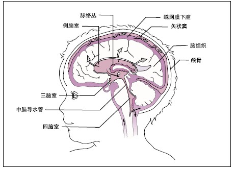 3岁半孩子患病成大头娃娃先天性脑积水知多少