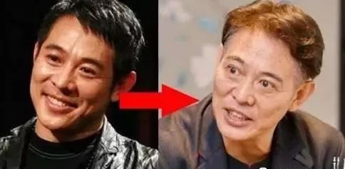 纠缠李连杰的甲亢是一种什么样的病?