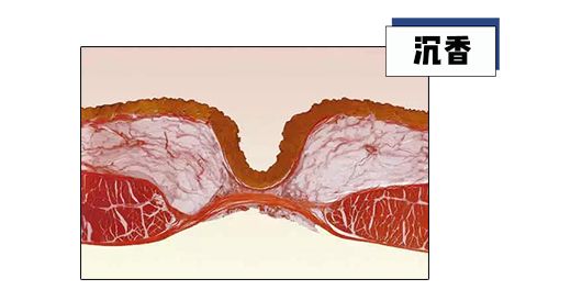 肚脐眼到底能不能抠?被骗了这么多年, skr skr