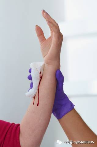 说说这项治疗——【静脉放血】与真红(pv)之间的关系