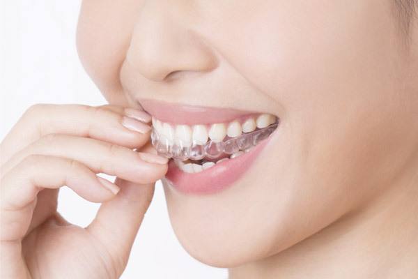 全口牙套太难看,只想做单排牙套行不行?