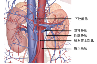 女性左肾静脉胡桃夹图片