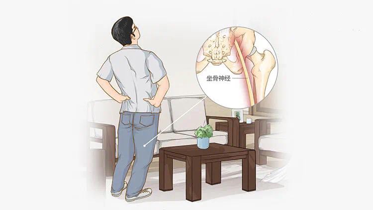 為什麼腰4腰5及腰5骶1椎間盤突出症最為常見